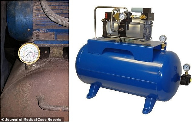 gan may nen khi vao hau mon cua ban de nghich va hau qua khung khiep hinh anh 1