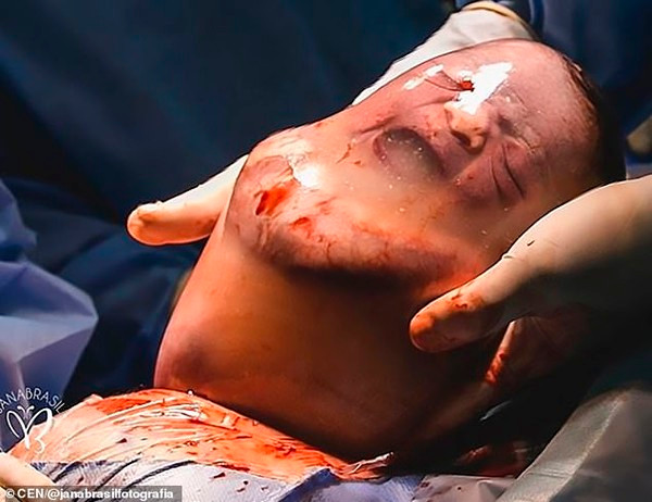 … một lúc sau thì òa khóc như cảm thấy phiền vì đang ngủ ngon thì bị đưa ra ngoài.