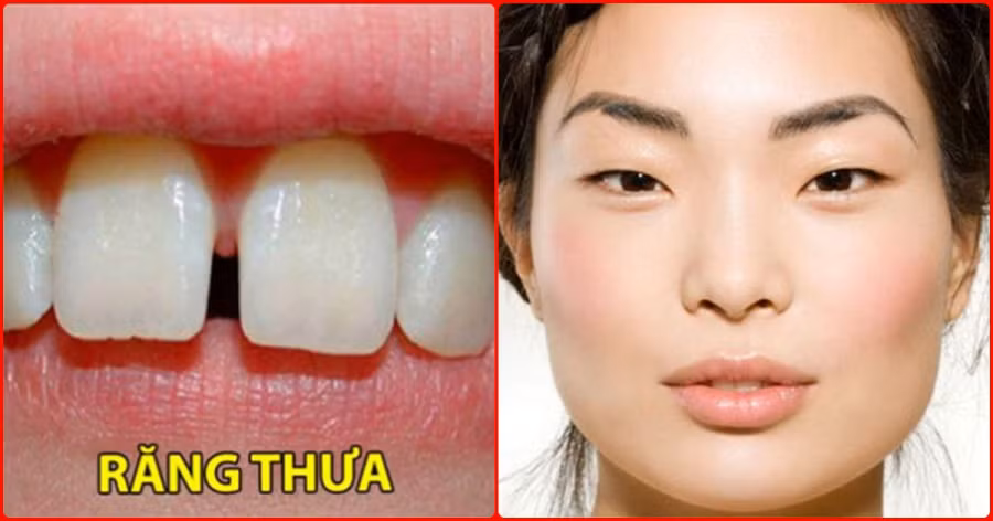 VN_15c66346e9788f5619c97074t09a25b5e