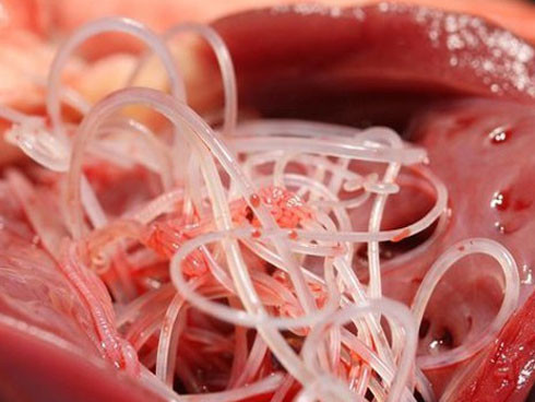 Bác sĩ phát hoảng khi lôi con ký sinh trùng dài 9cm từ não của cô gái 16 tuổi: Cảnh báo cẩn trọng từ món ăn nhiều người thích ảnh 2