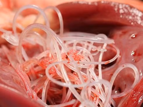 Bác sĩ phát hoảng khi lôi con ký sinh trùng dài 9cm từ não của cô gái 16 tuổi: Cảnh báo cẩn trọng từ món ăn nhiều người thích ảnh 2