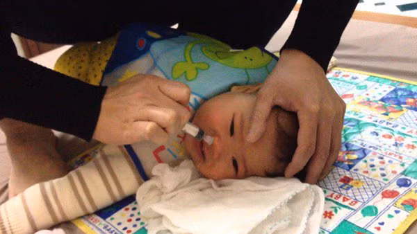 bac si chi cach cham soc tre bi viem mui di ung trong nhung ngay thay doi thoi tiet - 4