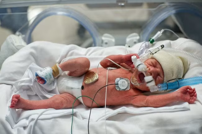 Hy hữu ca sinh mổ với đội ngũ y bác sĩ lên tới 35 người để giúp những… 6 em bé chào đời cùng lúc - Ảnh 5.