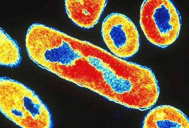 Cảnh báo: Nguy hiểm từ những chiếc đũa ăn hàng ngày, có thể gây bệnh ung thư? ảnh 2