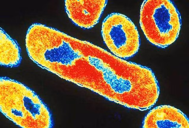 Cảnh báo: Nguy hiểm từ những chiếc đũa ăn hàng ngày, có thể gây bệnh ung thư? ảnh 2