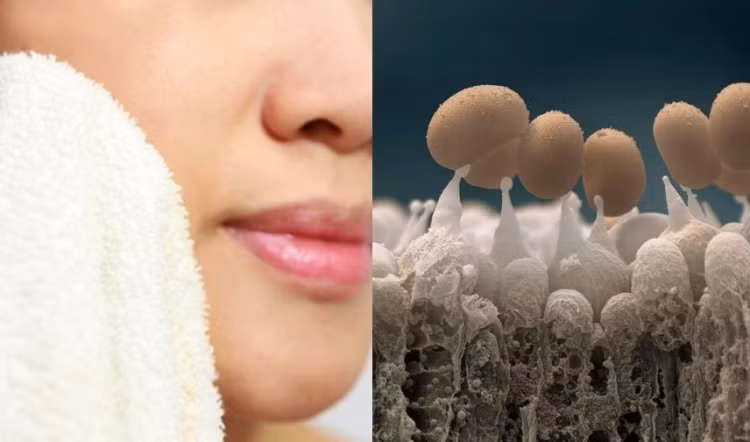 8 "tác nhân" này chính là thủ phạm khiến da bạn mụn mãi không hết ảnh 2 8 "tác nhân" này chính là thủ phạm khiến da bạn mụn mãi không hết ảnh 2