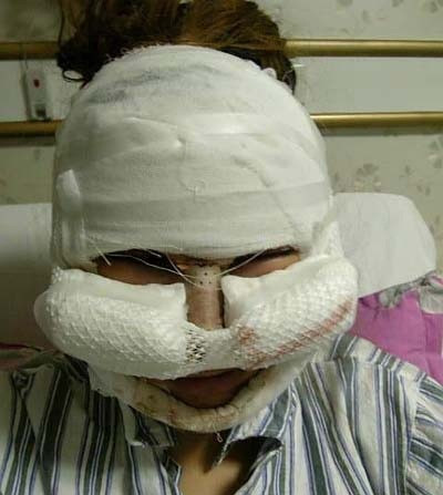 Cô gái 19 tuổi nhận kết đắng sau phẫu thuật: "Chỉ mong khuôn mặt trở lại bình thường" ảnh 1