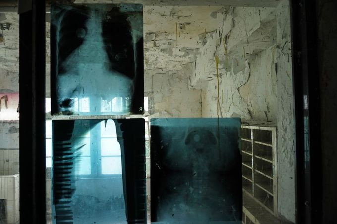 Lạnh người ghé thăm bệnh viện bỏ hoang ở Đài Bắc ảnh 7 Bệnh viện điều trị phong cùi bỏ hoang ở Đài Bắc