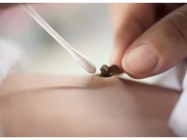 Bạn đừng sốt ruột hay lo lắng khi cuống rốn của bé lâu khô hơn các bé khác, hãy cứ để nó khô và rụng tự nhiên (Ảnh minh họa).