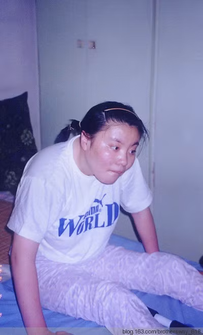 Vụ đầu độc bí ẩn chấn động Trung Quốc: Cô sinh viên ưu tú bỗng chốc trở thành đứa trẻ bại liệt, sau 25 năm vẫn không bắt được kẻ hạ độc-4