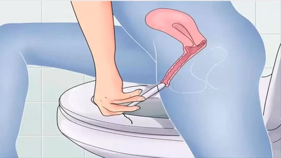 Mỹ thu hồi hoàng loạt băng vệ sinh gây nguy hiểm cho người dùng, phụ nữ Việt nếu đang sử dụng cần đặc biệt lưu ý-5