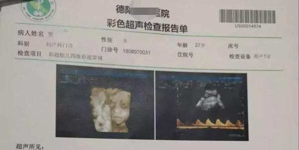 Đi siêu âm bác sĩ nói con thích nắm tay, bố mẹ “chết sững” lúc bé chào đời ảnh 1 di sieu am bac si noi con thich nam tay, bo me "chet sung" nhin be luc chao doi - 1