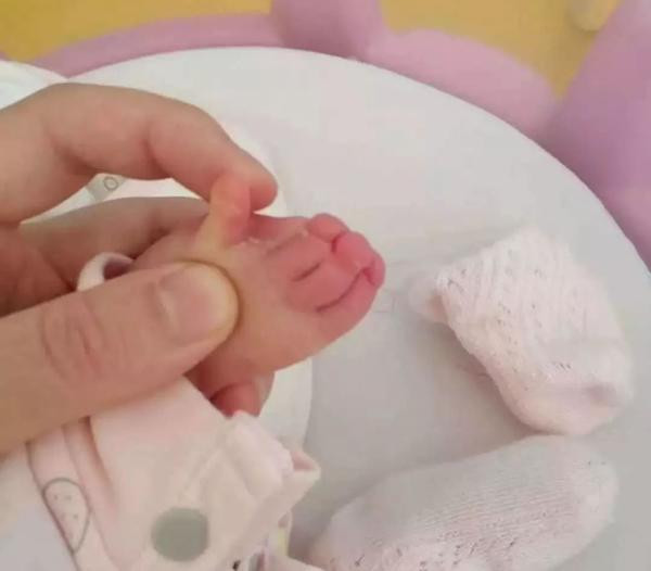 Đi siêu âm bác sĩ nói con thích nắm tay, bố mẹ “chết sững” lúc bé chào đời ảnh 3 di sieu am bac si noi con thich nam tay, bo me "chet sung" nhin be luc chao doi - 3
