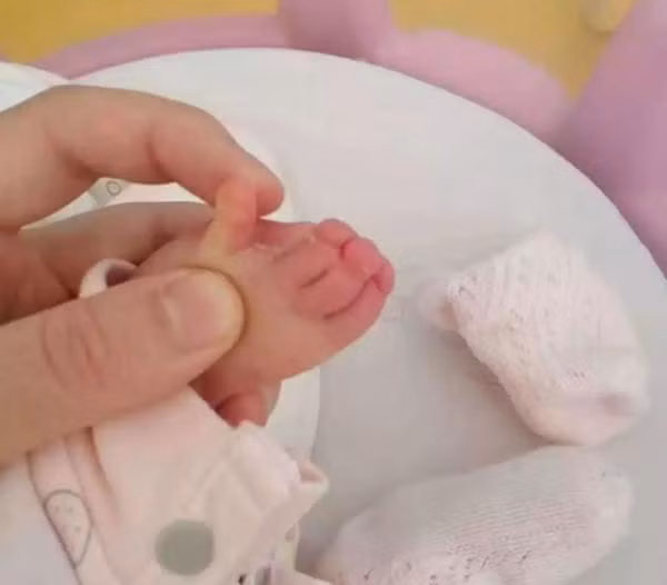 di sieu am bac si noi con thich nam tay, bo me "chet sung" nhin be luc chao doi - 3