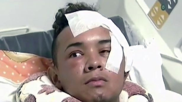 Alberto Palacio Vizcaino bị đâm bởi bạn trai em gái.