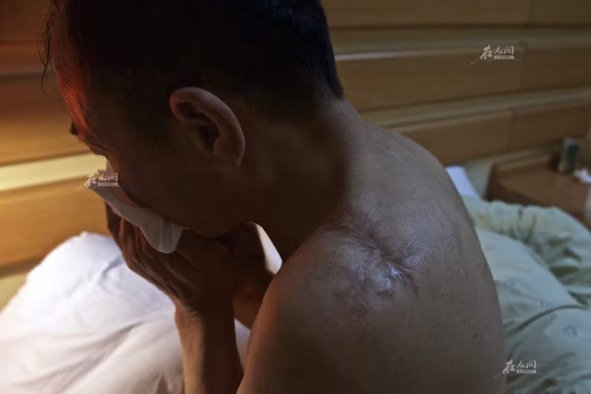 ‘Vua co bac’ Trung Quoc va noi dau mat doi chan, 3 ngon tay vi do den hinh anh 2 