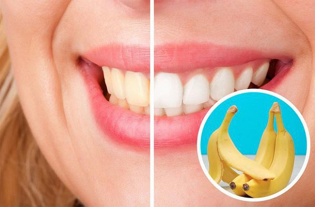 16 mẹo vặt cứu nguy chị em trong những tình huống “dở khóc dở cười” - Hình 12