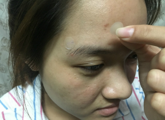 Miếng dán được quảng cáo có tác dụng xẹp mụn và hút sạch nhân mụn sau khi dán từ 8 - 12 tiếng. Miếng dán trị mụn được quảng cáo có tác dụng xẹp mụn và hút sạch nhân mụn sau khi dán từ 8 - 12 tiếng. Ảnh: Cẩm Anh