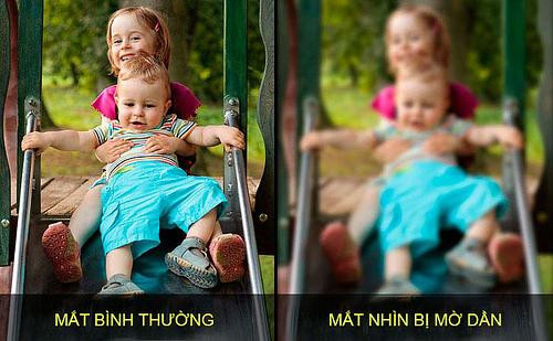 Mờ mắt – dấu hiệu quan trọng cảnh báo vấn đề sức khỏe bạn không thể bỏ qua ảnh 1 Mờ mắt – dấu hiệu quan trọng cảnh báo vấn đề sức khỏe bạn không thể bỏ qua ảnh 1