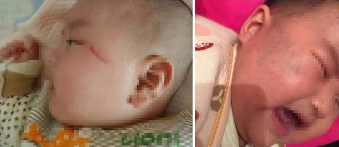 con nga tu tren giuong xuong dat, 90% cha me hanh dong sai lam dan den nguy hiem - 2