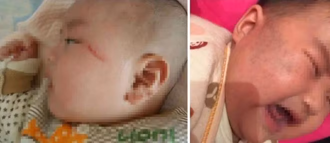 con nga tu tren giuong xuong dat, 90% cha me hanh dong sai lam dan den nguy hiem - 2