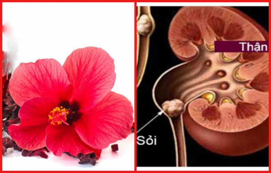 Loài hoa mọc dại ven đường nhưng ít ai biết có thể “đánh bay sỏi thận" ảnh 1 Empty