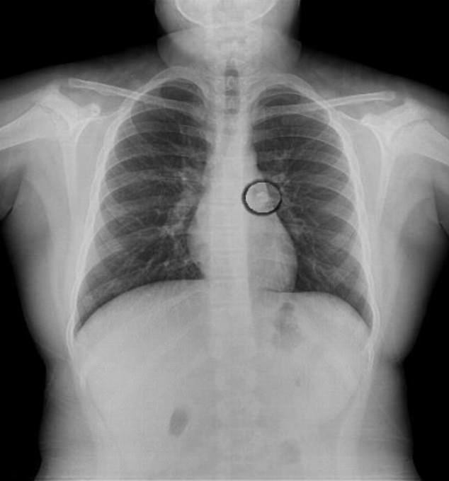 sang day dot nhien thay con mat rang, cha me voi dua con vao vien moi biet su that - 1