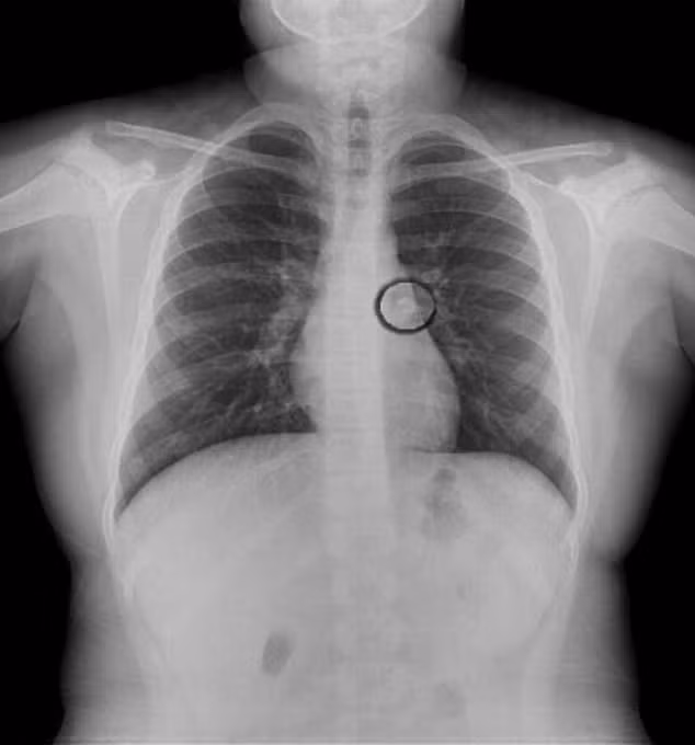 sang day dot nhien thay con mat rang, cha me voi dua con vao vien moi biet su that - 1