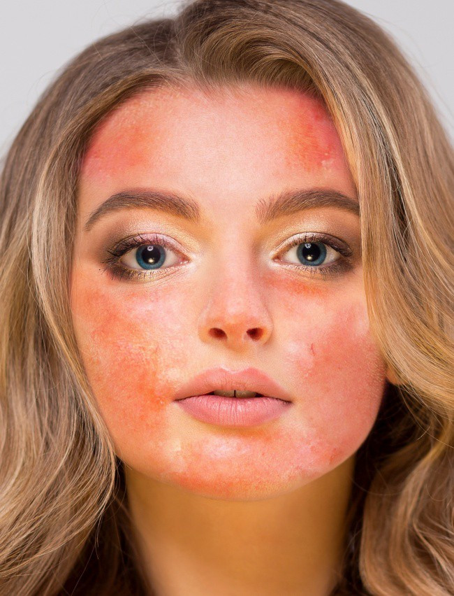 4 sản phẩm tự nhiên thường được khuyên để dưỡng da mặt nhưng thực ra lại gây hại không tưởng, chị em phải cẩn thận - Ảnh 3. 4 sản phẩm tự nhiên thường được khuyên để dưỡng da mặt nhưng thực ra lại gây hại không tưởng, chị em phải cẩn thận - Ảnh 3.