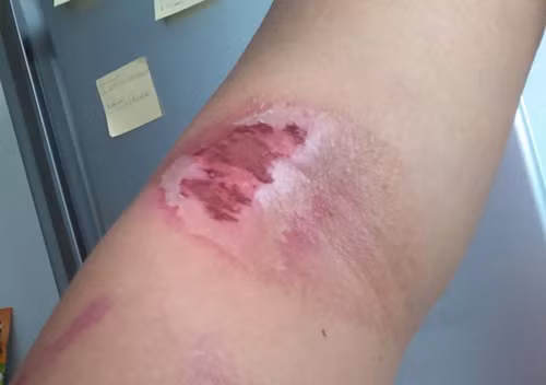 Cách đuổi kiến ba khoang ở khu nhà cao tầng, chung cư - ảnh 3