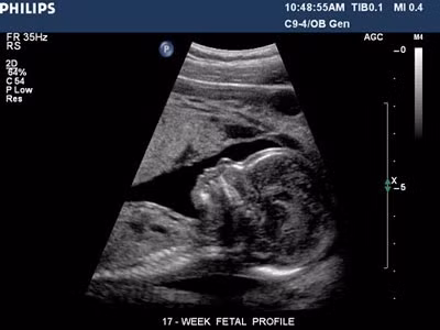 Những chữ viết tắt được dùng để mô tả tư thế nằm của em bé trong tử cung.