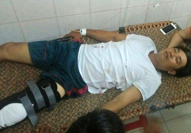 Nạn nhân Trần Minh Triết bị bắn vào chân.