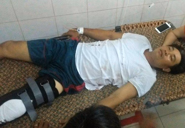 Nạn nhân Trần Minh Triết bị bắn vào chân.