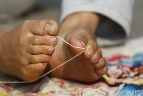 Chàng trai khuyết tật gây ‘sốt’ với khả năng thêu bằng… chân ảnh 5 Chàng trai khuyết tật gây ‘sốt’ với khả năng thêu bằng… chân - ảnh 5