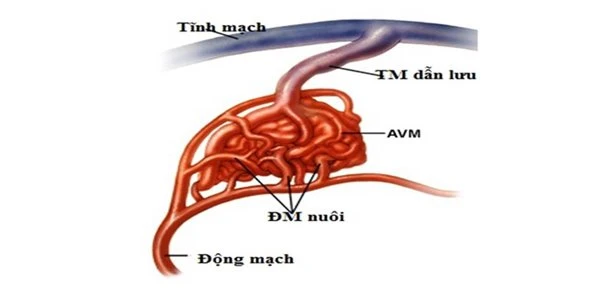 Người phụ nữ có gương mặt chực vỡ tung vì nguyên nhân lạ