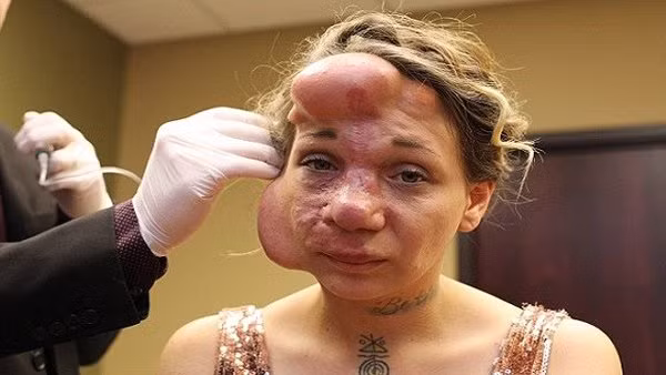 Người phụ nữ có gương mặt chực vỡ tung vì nguyên nhân lạ