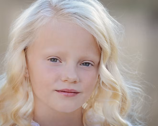 Chỉ một số ít người trên thế giới sở hữu đặc điểm lạ lùng này - Ảnh 6.