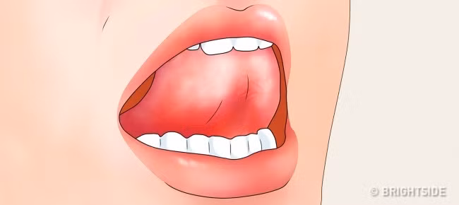 Chỉ một số ít người trên thế giới sở hữu đặc điểm lạ lùng này - Ảnh 13.