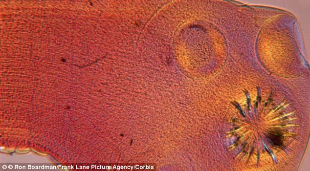 Phát hiện con sán dài hơn 6m trong bụng người đàn ông ảnh 3