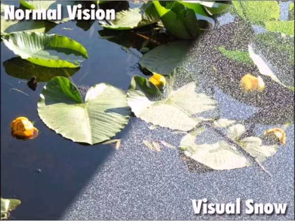 hien-tuong-thi-giac-ky-la