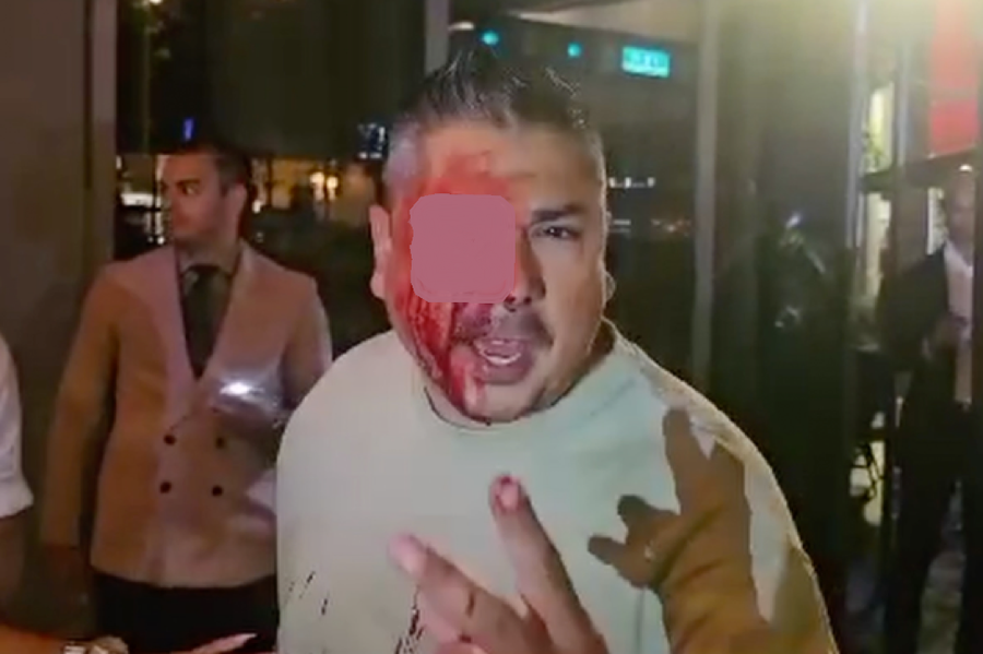 ...cổ động viên này bị đánh ‘sứt đầu mẻ trán’. ...cổ động viên này bị đánh ‘sứt đầu mẻ trán’.