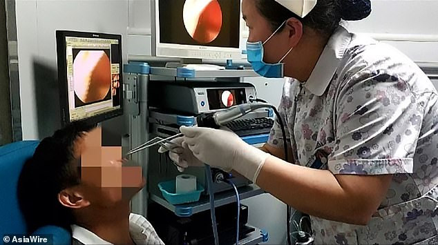 Chảy máu mũi nhiều ngày, đi khám bác sỹ lôi ra 2 con đỉa “ngoe nguẩy” hình ảnh 1 chay mau mui nhieu ngay, di kham bac sy loi ra 2 con dia “ngoe nguay” hinh anh 1