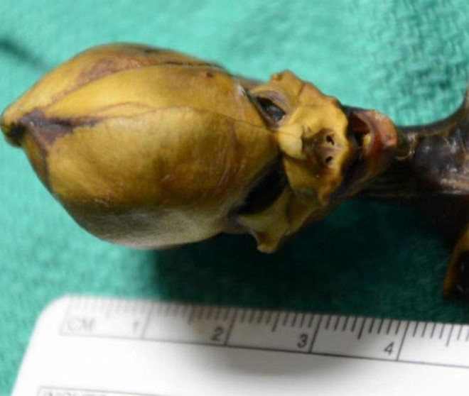 Đã có lời giải về bộ xương "người ngoài hành tinh" bí ẩn ảnh 3 Bi an bo xuong