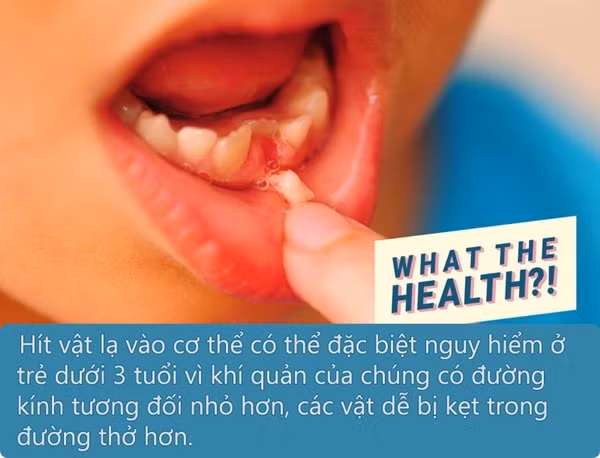 Sáng ngủ dậy thấy con mất 1 chiếc răng trong miệng, bố mẹ nhanh chóng đưa đến viện nên đã cứu được con-1
