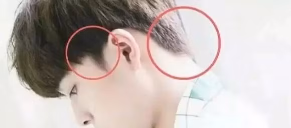 tóc dấu phẩy, sao hàn để tóc dấu phẩy, Comma hair