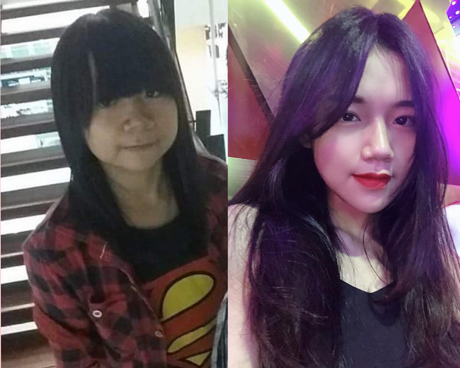 Bị bạn học trêu chọc là xấu xí, cô gái đợi đến 19 tuổi để phẫu thuật thẩm mỹ thành hot girl-9