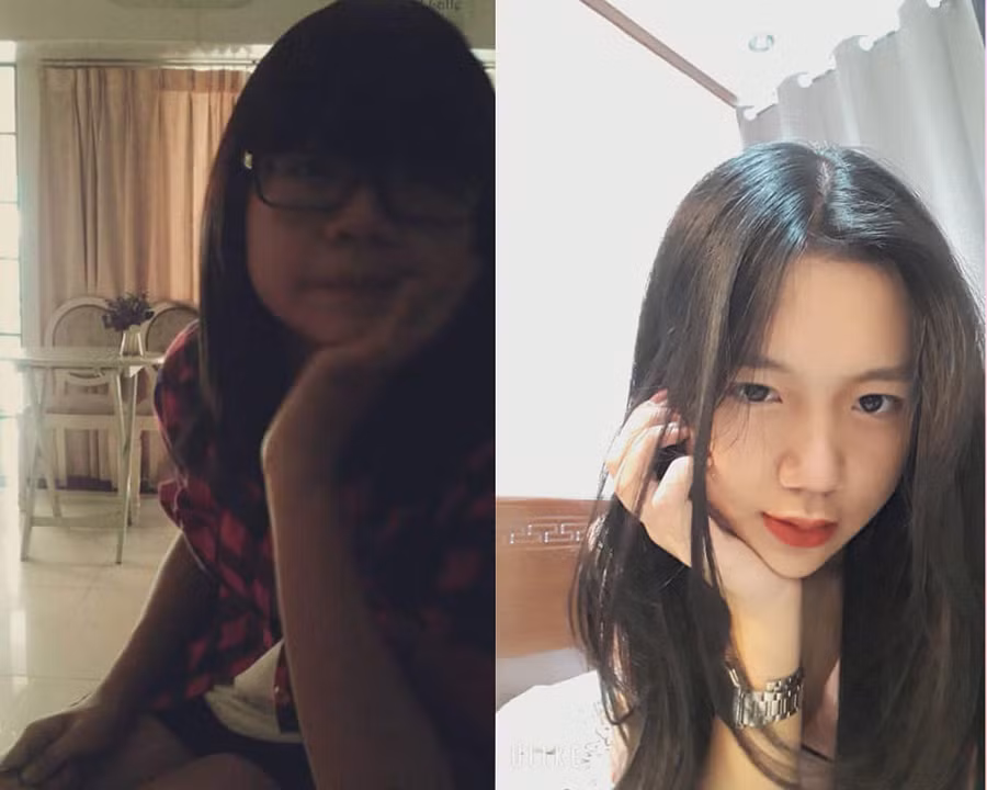 Bị bạn học trêu chọc là xấu xí, cô gái đợi đến 19 tuổi để phẫu thuật thẩm mỹ thành hot girl-7