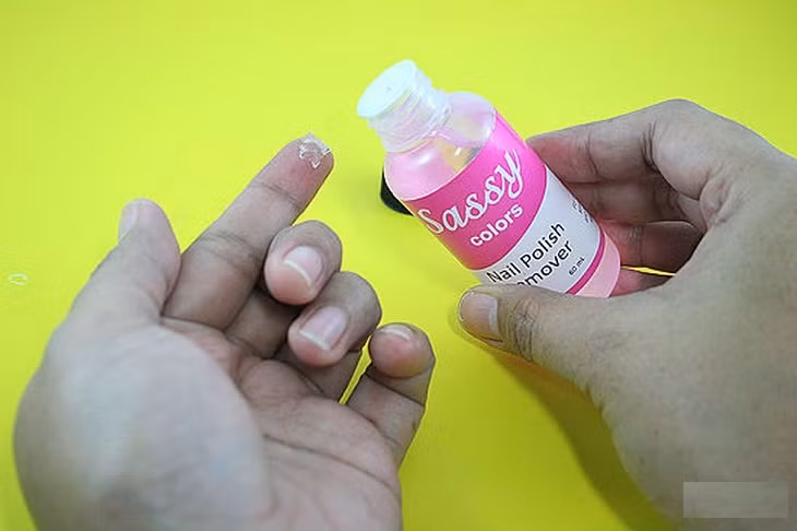 Cách gỡ keo 502 dính vào da cực đơn giản ai cũng phải thuộc lòng để phòng thân