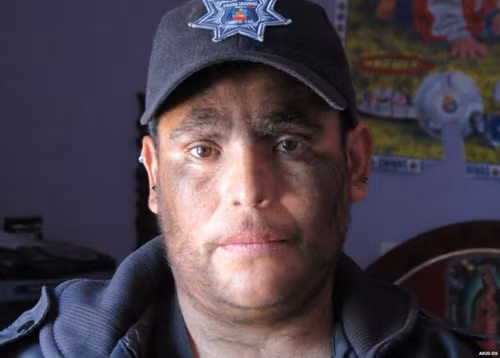 Những người sói có thật và cuộc đời đầy bi đát ảnh 10