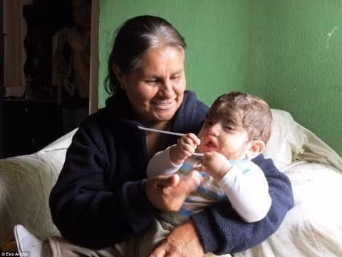 Những người sói có thật và cuộc đời đầy bi đát ảnh 2